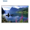ventilator display screen